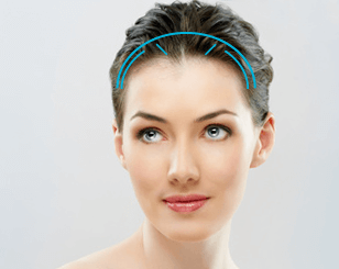 forehead lift dallas