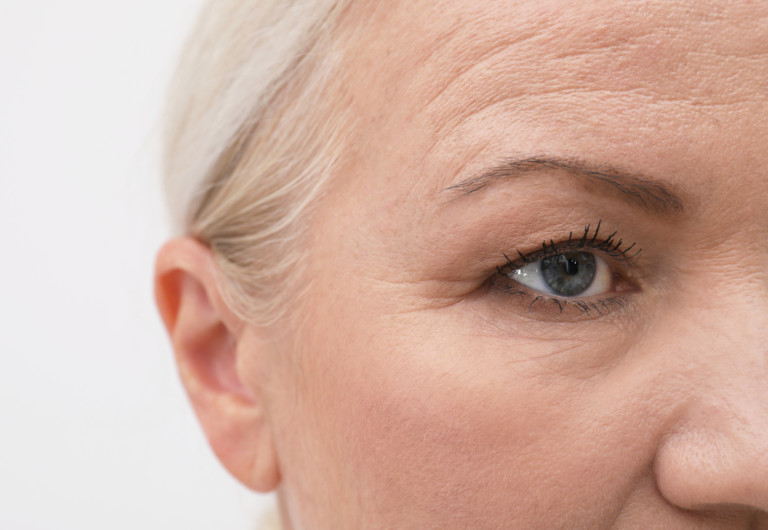 how-long-is-recovery-after-a-brow-lift-facial-plastic-surgery